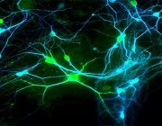 简述脉冲神经网络 SNN：下一代神经网络