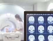 英国最大医院之一UCLH将采用AI提升医疗服务效率